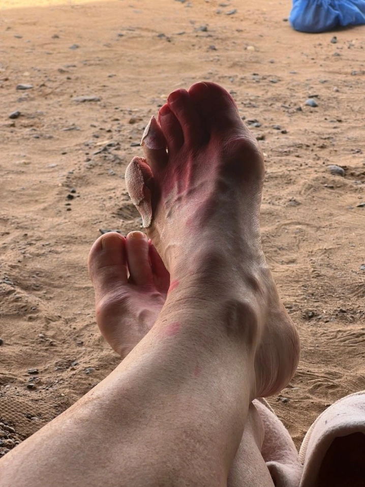 preview_image