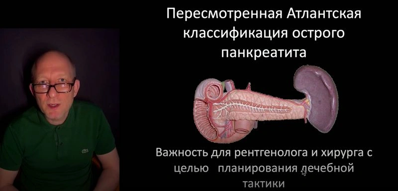 Единственная дельная классификация острого панкреатита