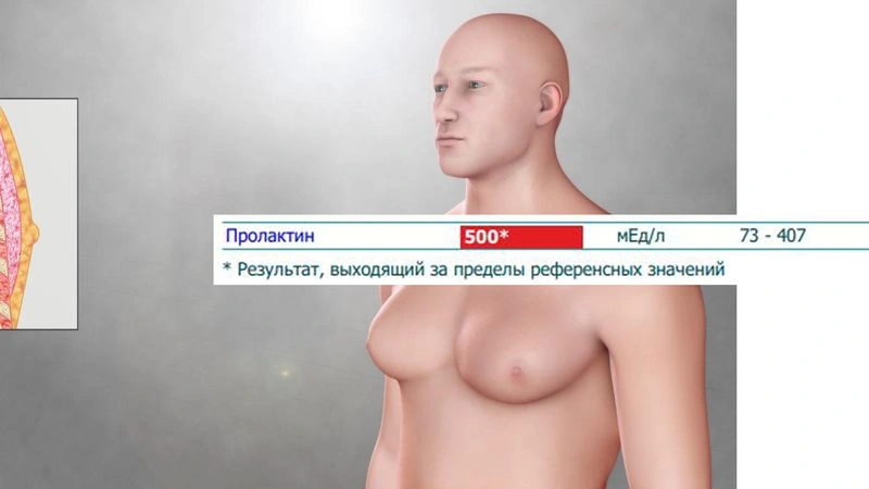 ПОВЫШЕН ПРОЛАКТИН (МАНУАЛ)