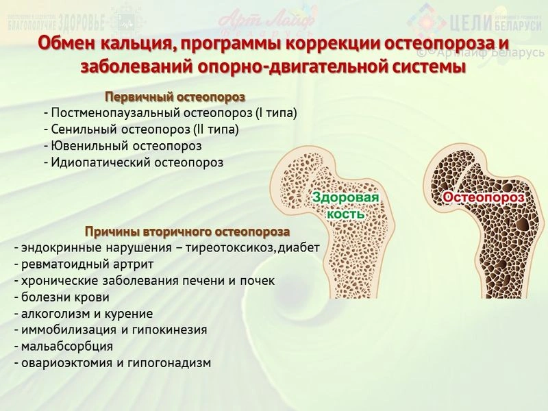 Остеопороз, профилактика, коррекция. Обмен кальция. Часть I