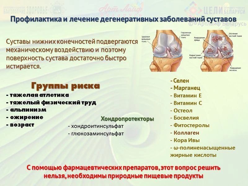 Профилактика и коррекция при дегенеративных заболеваниях суставов.