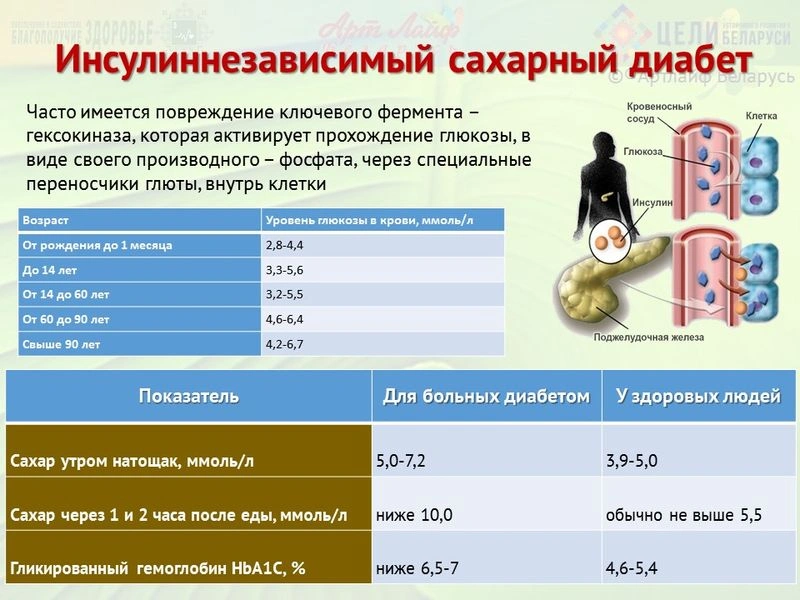 Уровень сахара в крови, первые симптомы развития инсулиннезависимого сахарного диабета.
