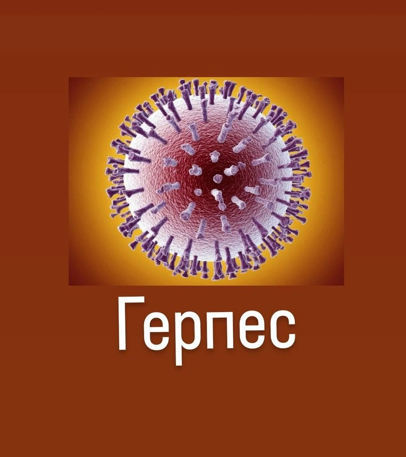 Герпес