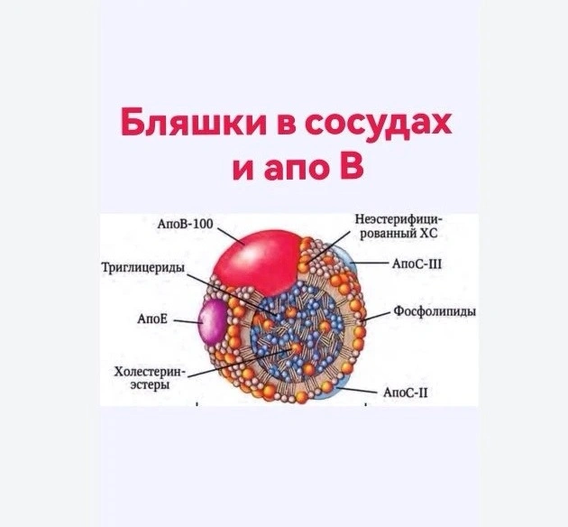 Бляшки в сосудах и  апо В белок