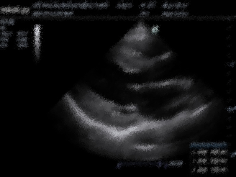 preview_image