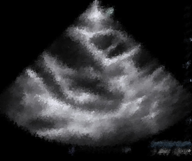 preview_image
