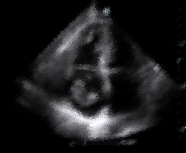 preview_image