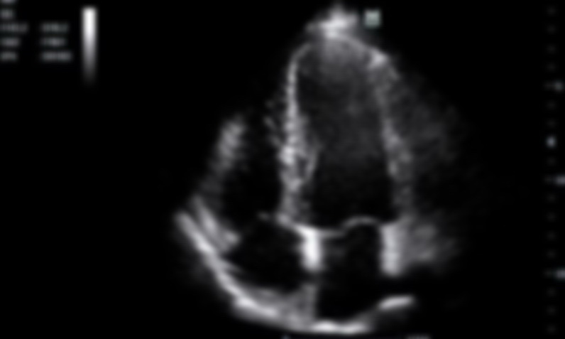 preview_image