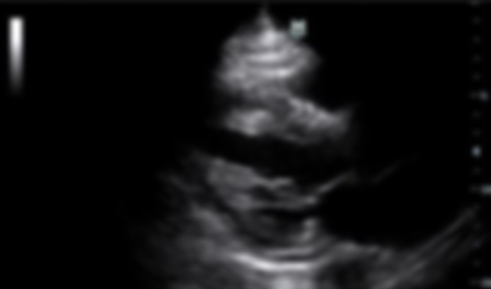 preview_image