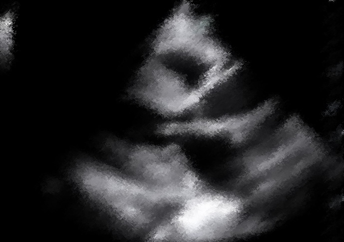 preview_image