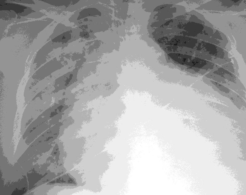 preview_image