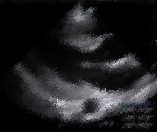 preview_image