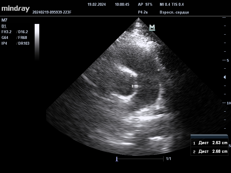 preview_image