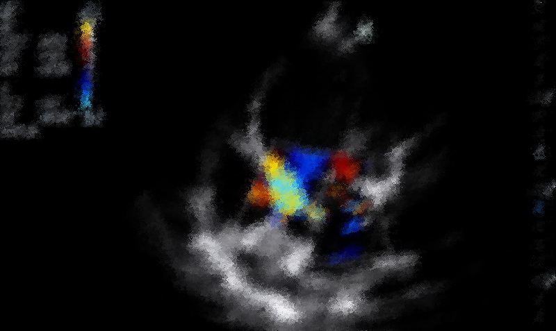 preview_image