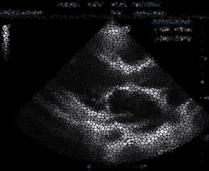 preview_image