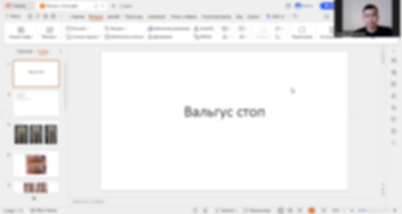Вальгус стоп. Лекция