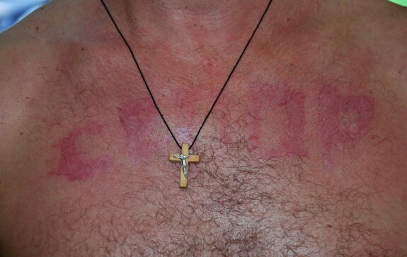 Жертва пыток со стороны украинских военных или военизированных формирований. У мужчины на груди выжжено слово "сепар".