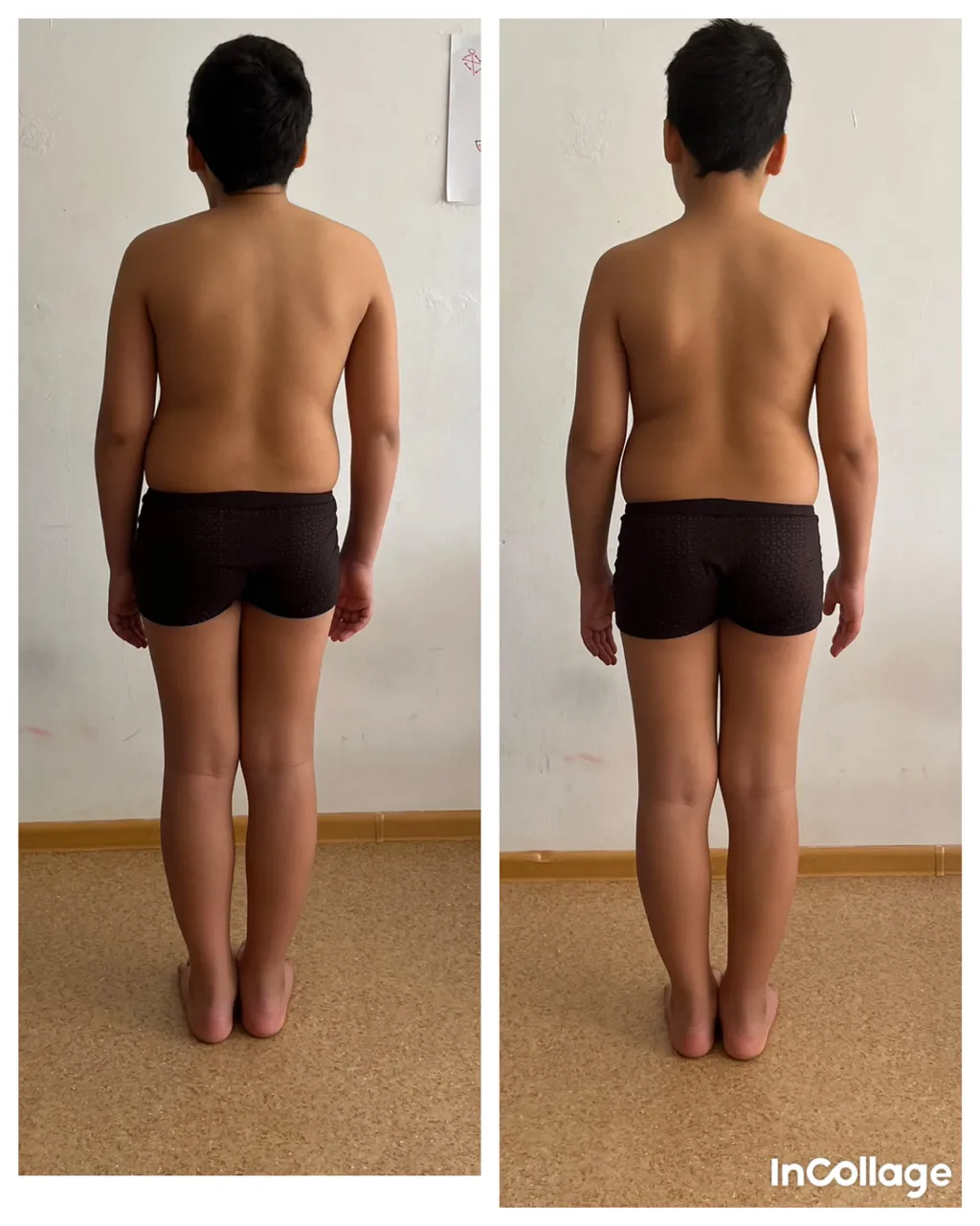 Работали по стратегии вальгус колен. Есть нюанс