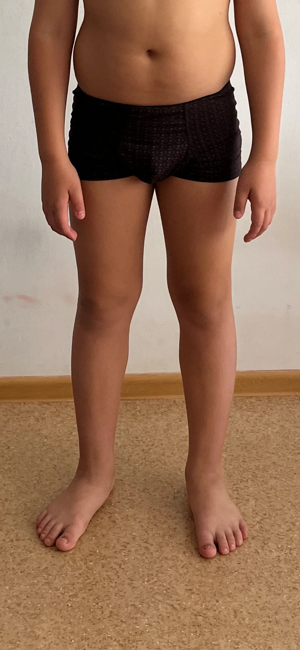 Работали по стратегии вальгуса колен. По фото бедра и колени стали меньше прижиматься друг к другу. Нюанс в правой ноге, которая делает ротацию бедра наружу. Без проработки этой ротации вальгус колена не исправить. Веротянее всего это какие-то из ягодичных мышц: короткая, длинная и средняя. Или они все вместе, Проработка ягодичных мышц уменьшает натяжение правой поясничной мышцы, где по фото видно, что тело становится чуть ровнее, Далее работаем по стратегии вальгуса колен и с правыми ягодичными мышцами